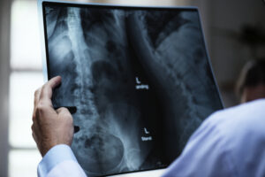 TARDIVA DIAGNOSI ONCOLOGICA: COME OTTENERE IL RISARCIMENTO